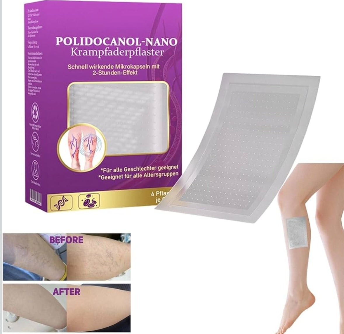 8x POLIDOCANOL-NANO obliži proti krčnim žilam (2x4kom)