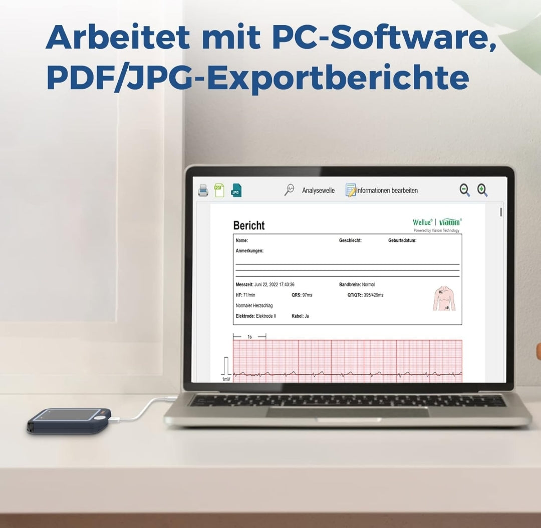 Profesionalni prenosni EKG merilnik z Bluetooth povezavo Naklikaj.si prikazuje srčni utrip 78 in EKG valovanje na zaslonu. Priklopljeni sta rdeča in bela elektrodna žica za preprosto spremljanje ritma kjerkoli.