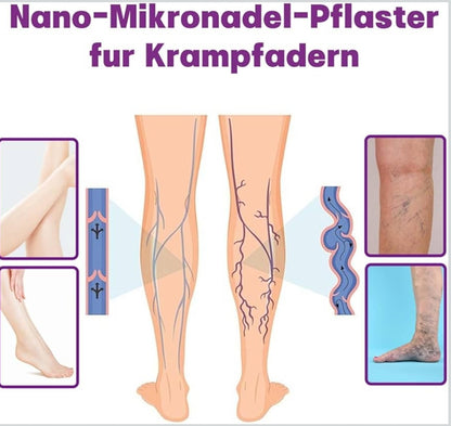 8x POLIDOCANOL-NANO obliži proti krčnim žilam (2x4kom)