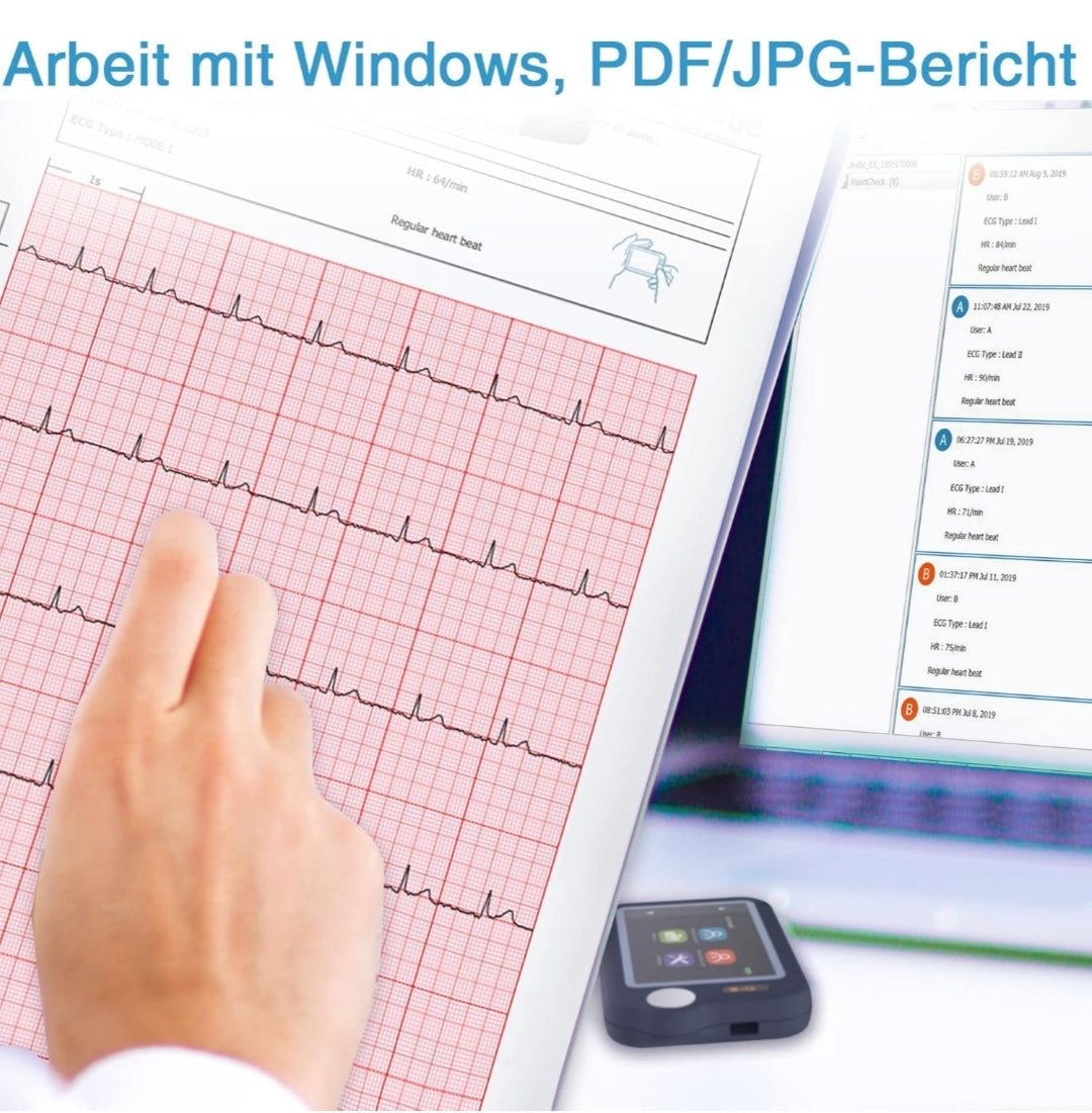 Profesionalni prenosni EKG merilnik z Bluetooth povezavo Naklikaj.si prikazuje srčni utrip 78 in EKG valovanje na zaslonu. Priklopljeni sta rdeča in bela elektrodna žica za preprosto spremljanje ritma kjerkoli.